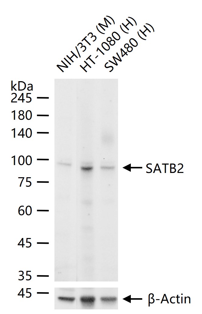 SATB2 Recombinant Rabbit mAb(b
