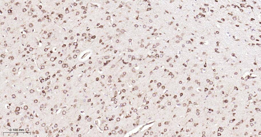 P4HB Recombinant Rabbit mAb(bs