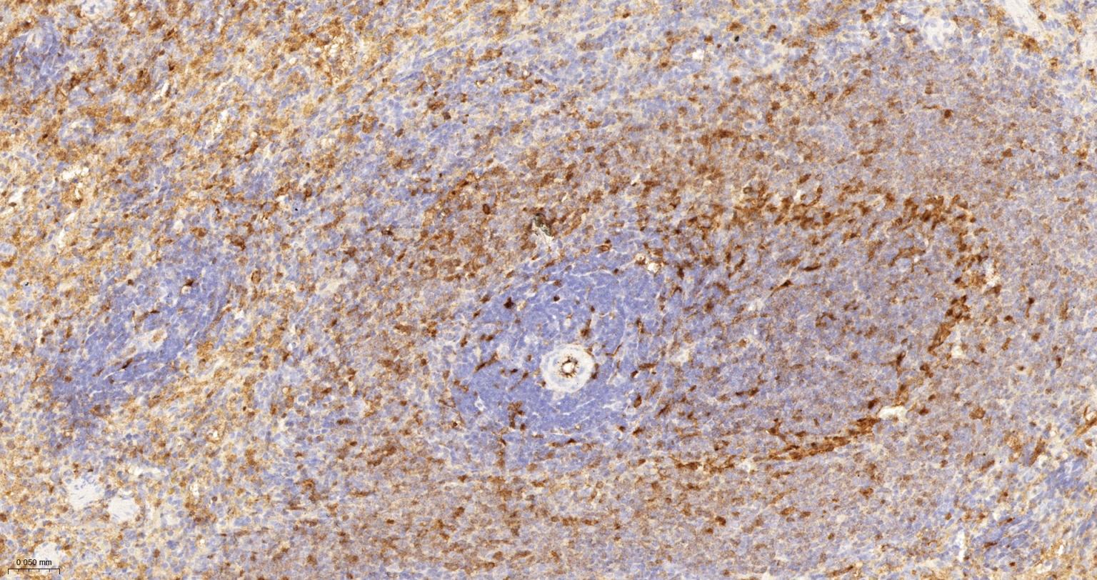 CD16 Recombinant Rabbit mAb(bs