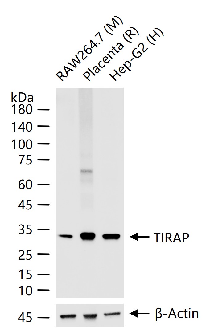 TIRAP Recombinant Rabbit mAb(b