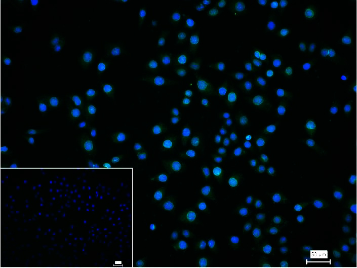 Lamin A/C Recombinant Rabbit m