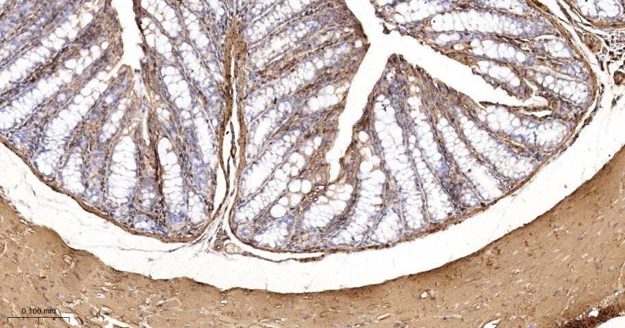 beta Actin Recombinant Rabbit 