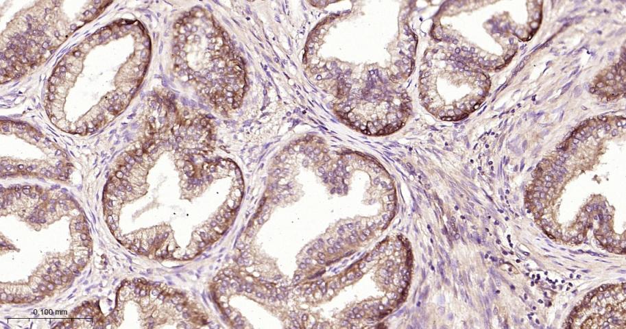 NME1/NM23A Recombinant Rabbit 