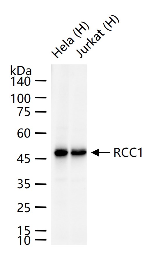 RCC1 Recombinant Rabbit mAb(bs