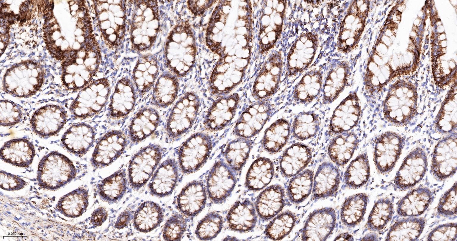 MDH2 Recombinant Rabbit mAb(bs