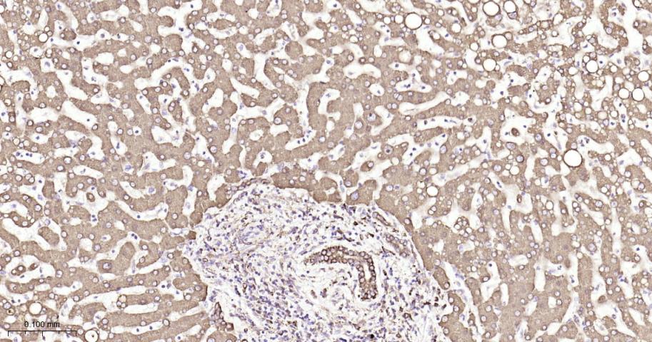 P4HB Recombinant Rabbit mAb(bs