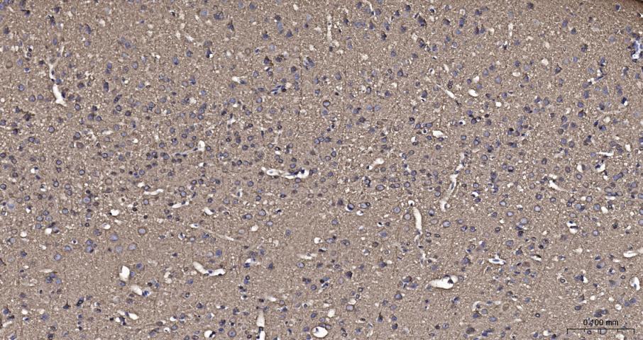 beta I Tubulin Recombinant Rab