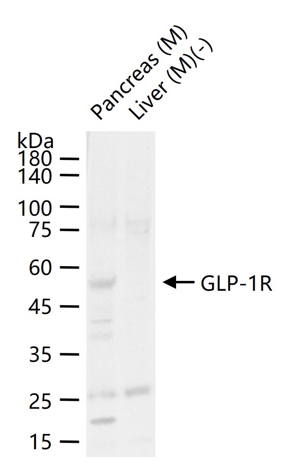 GLP-1R Rabbit pAb(bs-25810R)-5