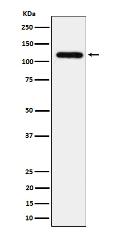 UBE4A Recombinant Rabbit mAb(b