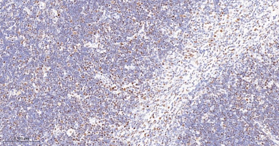 Oct-1 Recombinant Rabbit mAb(b