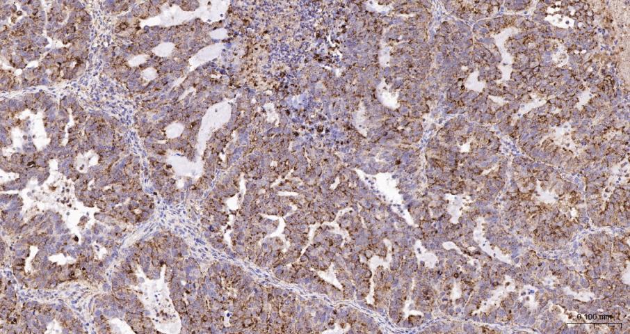 LAMP1 Recombinant  mAb(bsm-413