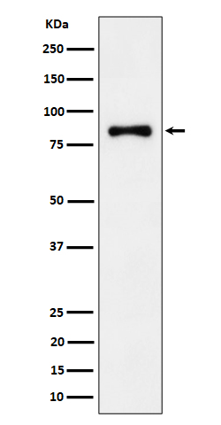 ALDH16A1 Recombinant Rabbit mA