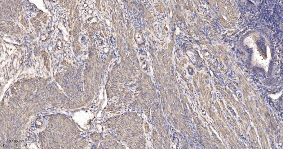 beta Actin Recombinant Rabbit 