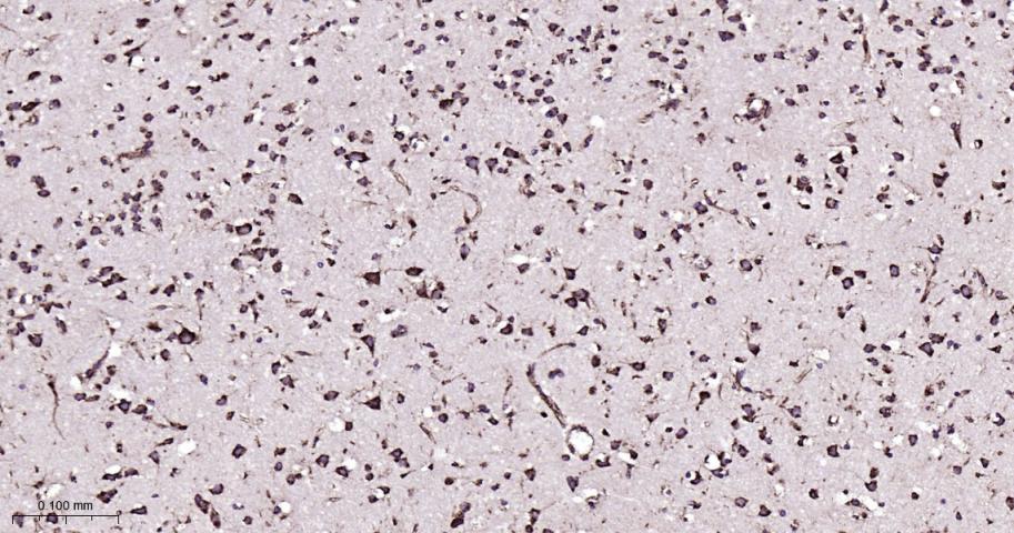 P4HB Recombinant Rabbit mAb(bs