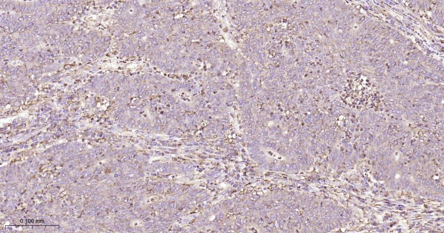 P4HB Recombinant Rabbit mAb(bs
