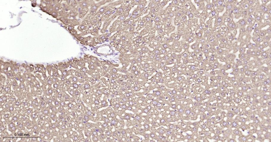 P4HB Recombinant Rabbit mAb(bs