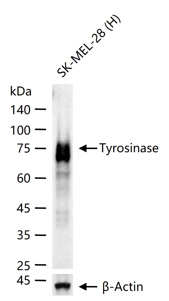 Tyrosinase Recombinant Rabbit 