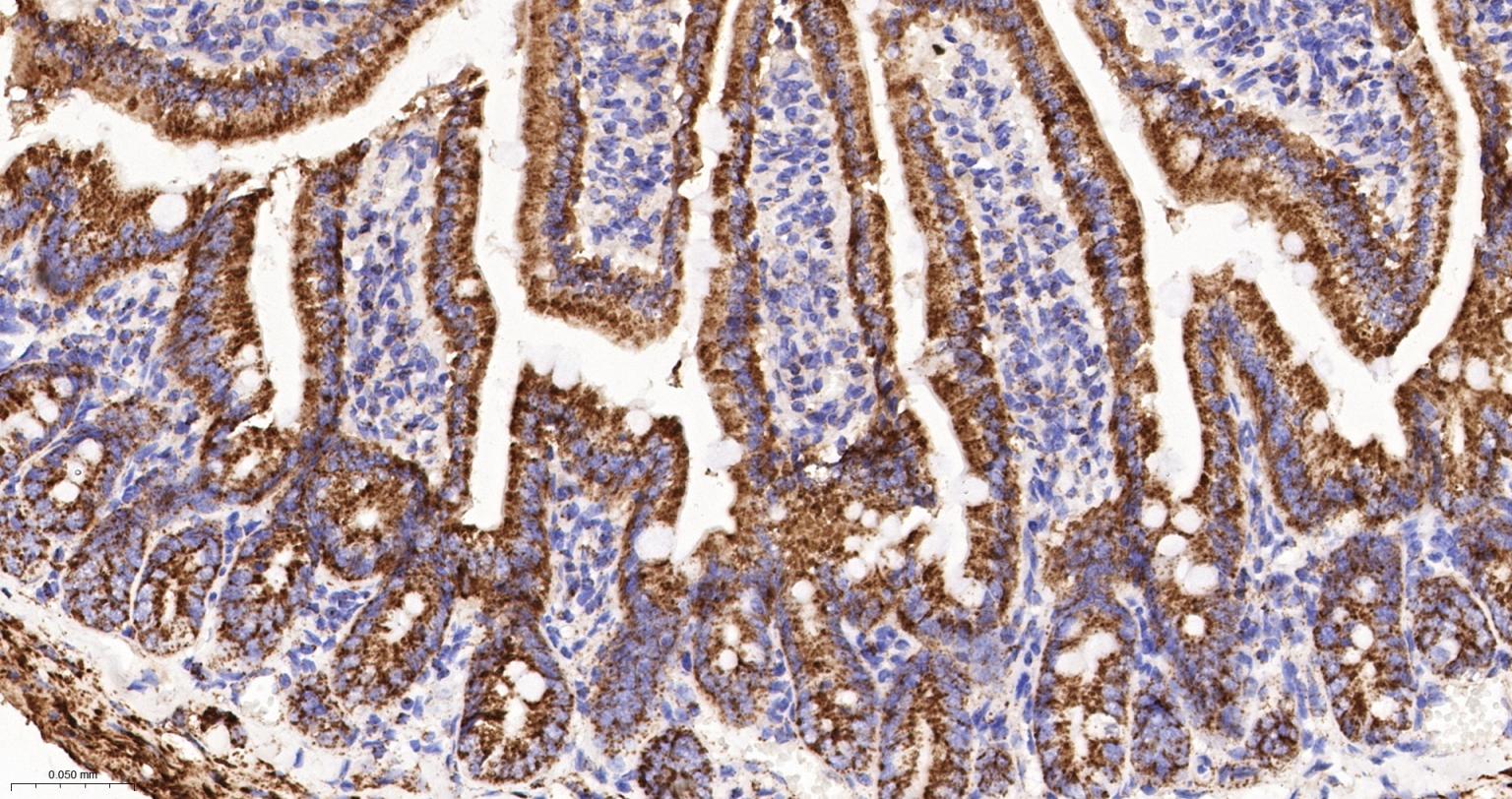 MDH2 Recombinant Rabbit mAb(bs