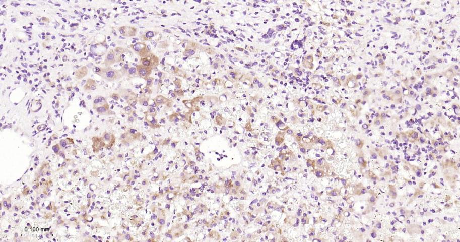 NDUFS3 Recombinant Rabbit mAb(