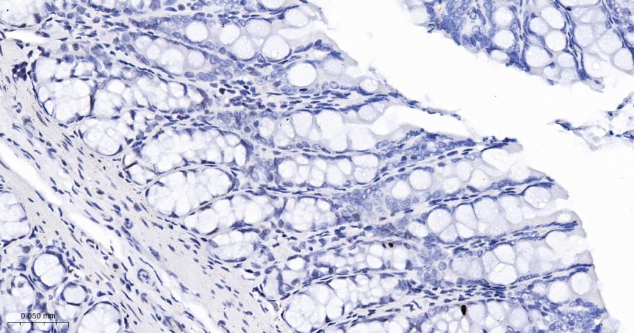 phospho-Histone H3 (S10) Recom