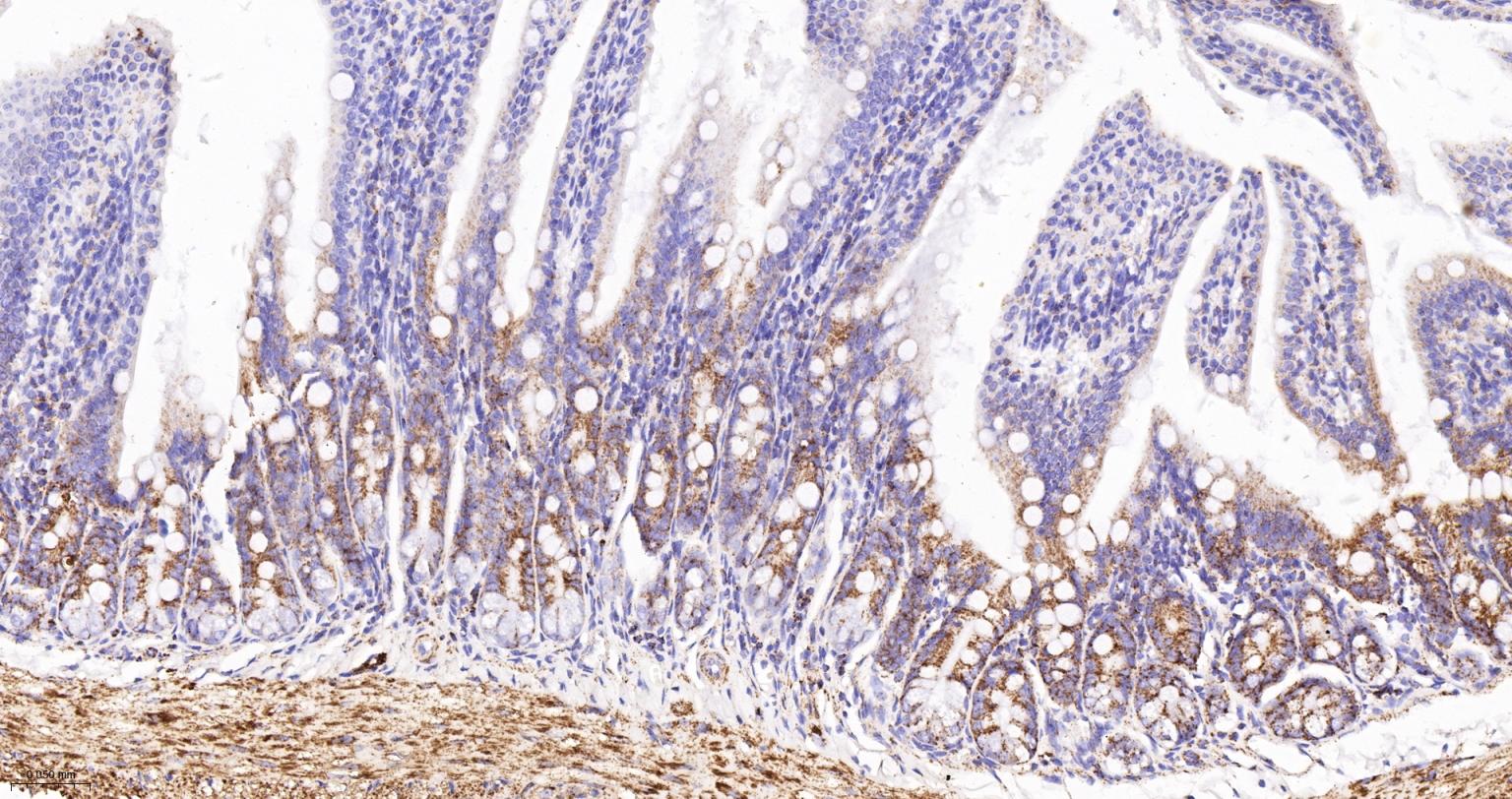 MDH2 Recombinant Rabbit mAb(bs