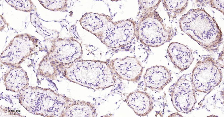 Versican Recombinant Rabbit mA