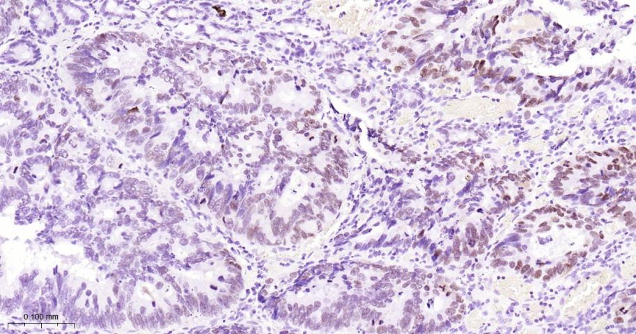 SATB2 Recombinant Rabbit mAb(b
