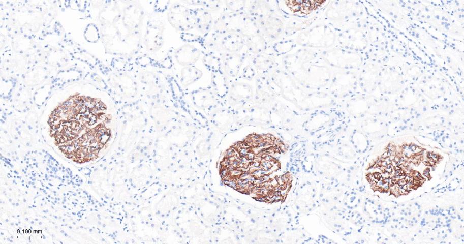 NPHS2 Recombinant Rabbit mAb(b