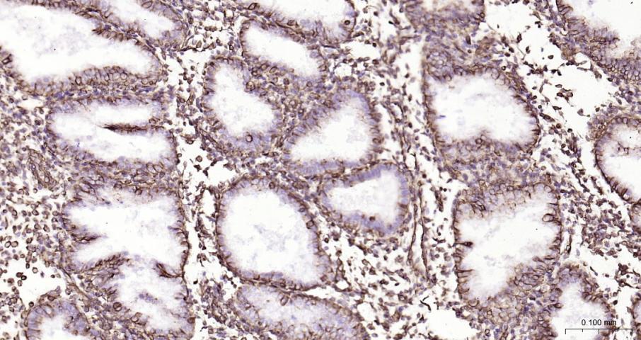 Vimentin Recombinant Rabbit mA