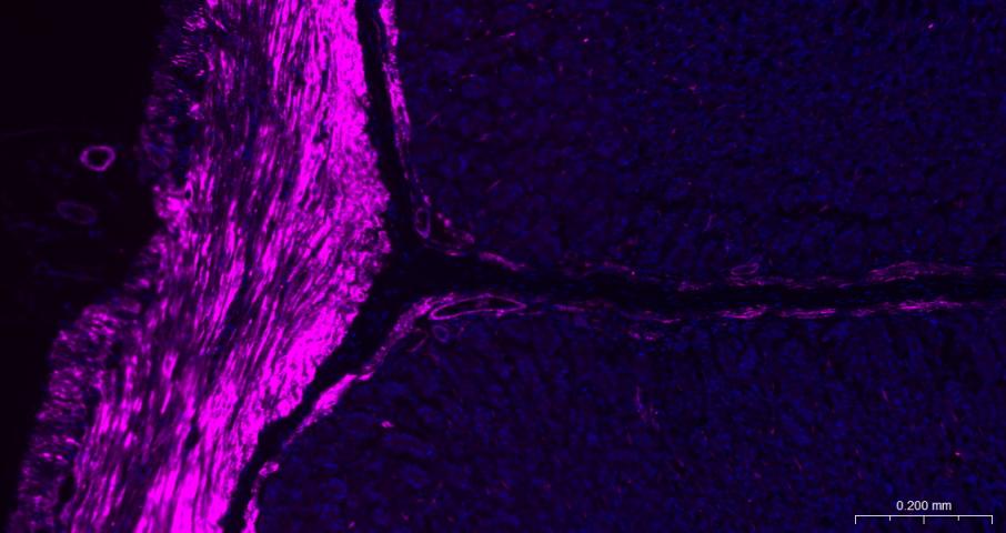alpha smooth muscle Actin Mous