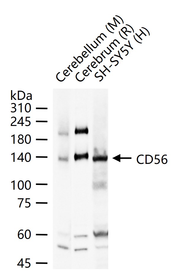 CD56 Rabbit pAb(bs-25840R)-50u