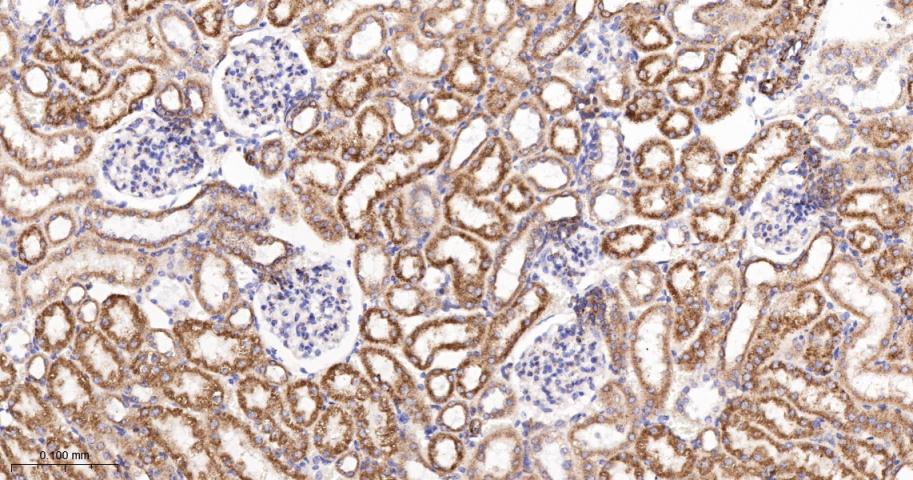SERCA2 Recombinant Rabbit mAb(