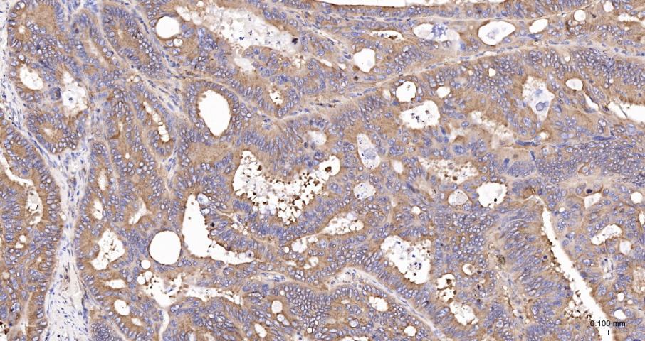 beta I Tubulin Recombinant Rab