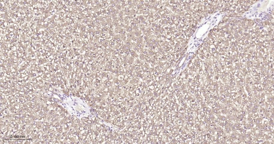 P4HB Recombinant Rabbit mAb(bs