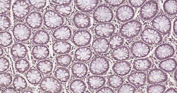 RAB8A Recombinant Rabbit mAb(b