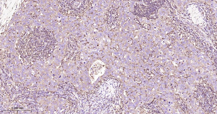 beta Actin Recombinant Rabbit 