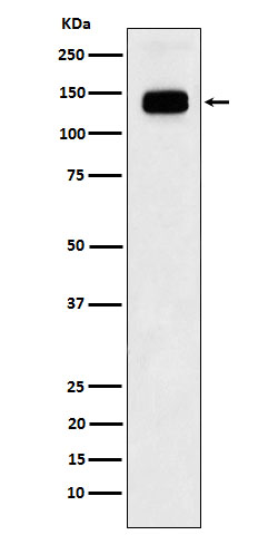 GTF2I Recombinant Rabbit mAb(b