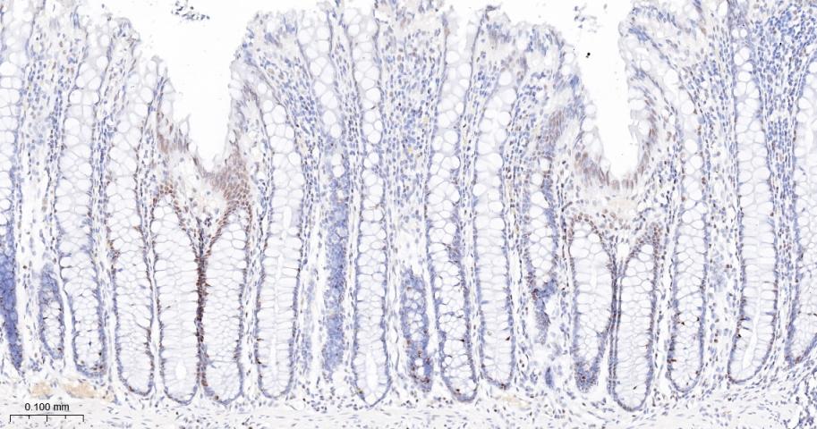 Oct-1 Recombinant Rabbit mAb(b