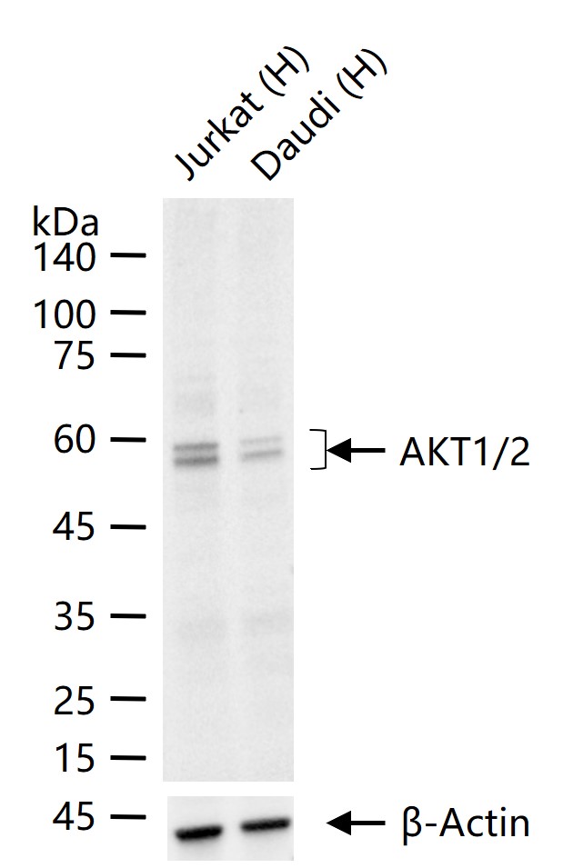 AKT1/2 Recombinant Rabbit mAb(