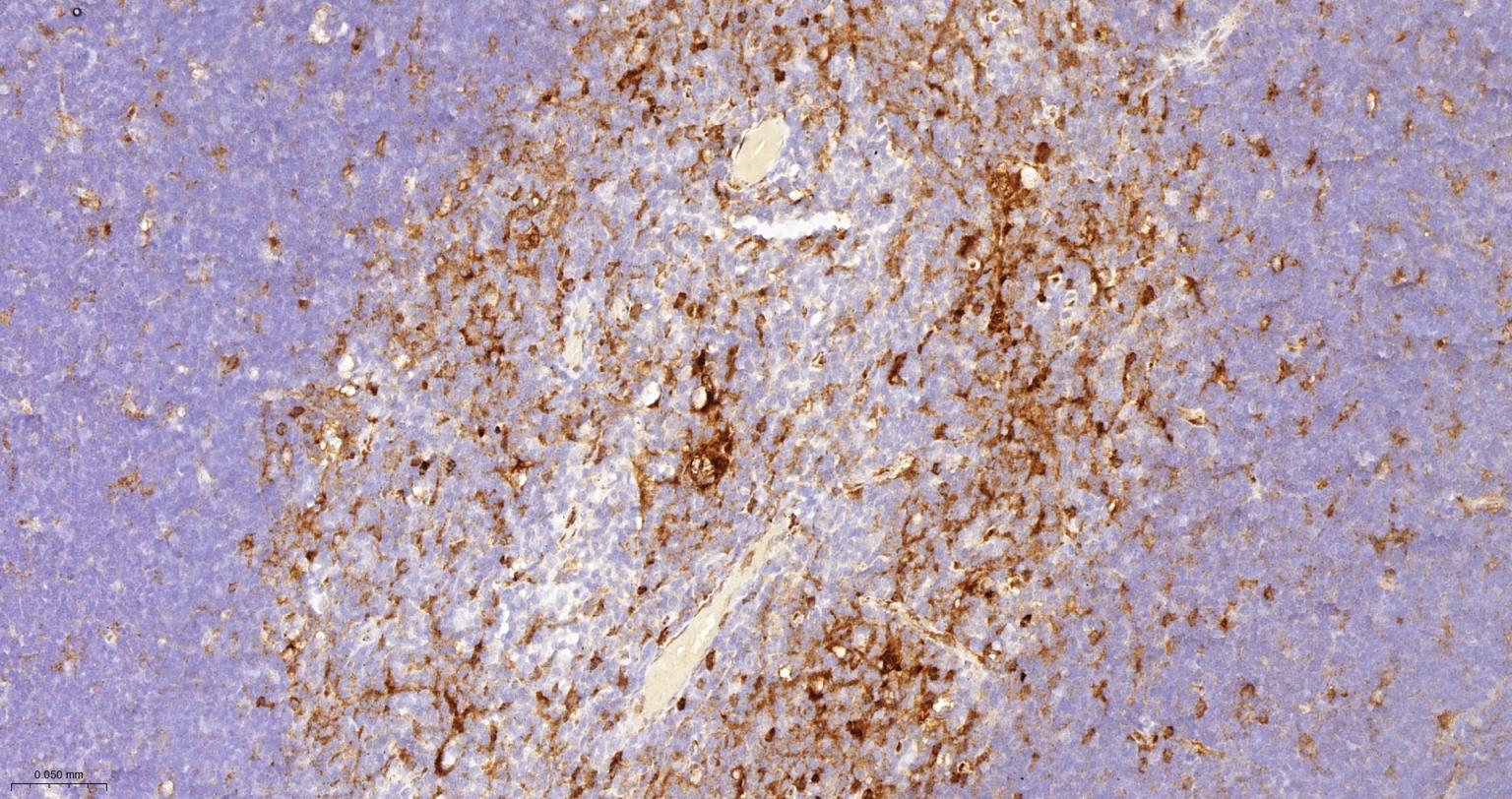 CD16 Recombinant Rabbit mAb(bs