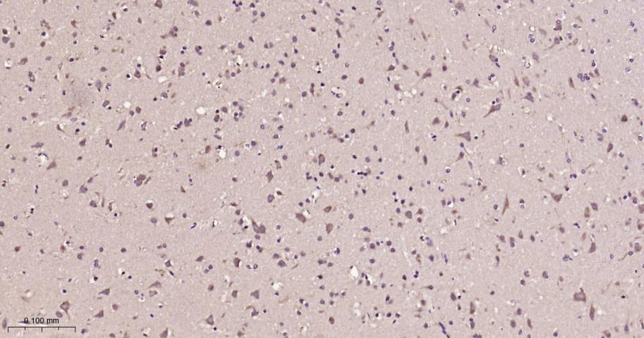 eIF3B Recombinant Rabbit mAb(b