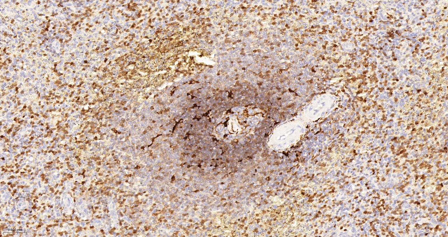 CD16 Recombinant Rabbit mAb(bs
