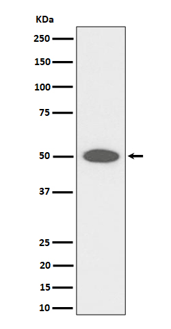 FGFR1OP Recombinant Rabbit mAb