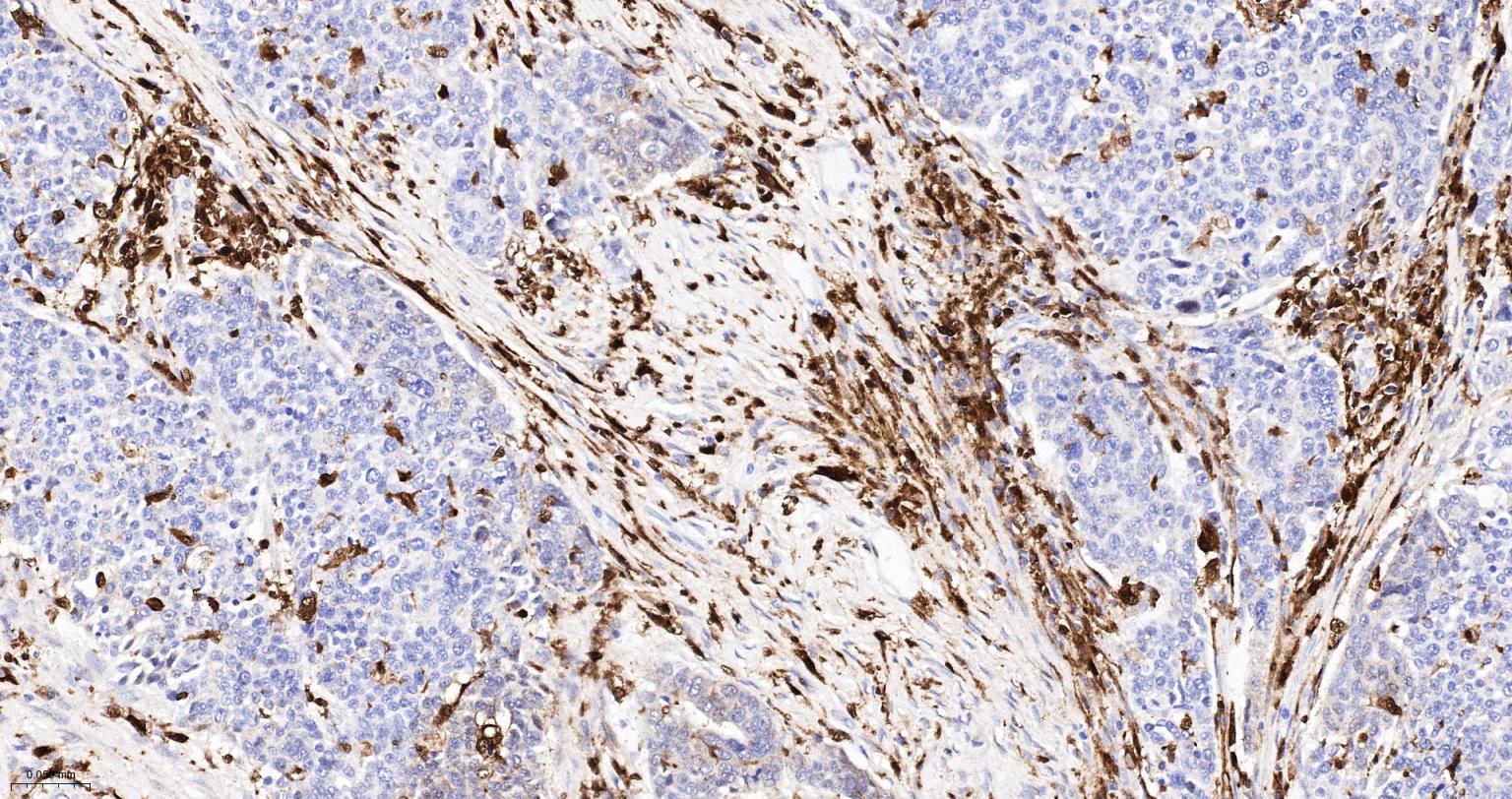 CD16 Recombinant Rabbit mAb(bs