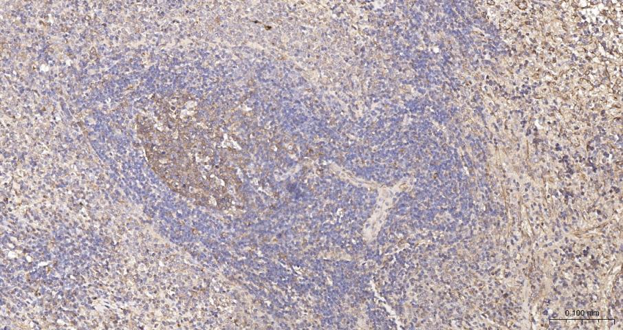 beta I Tubulin Recombinant Rab