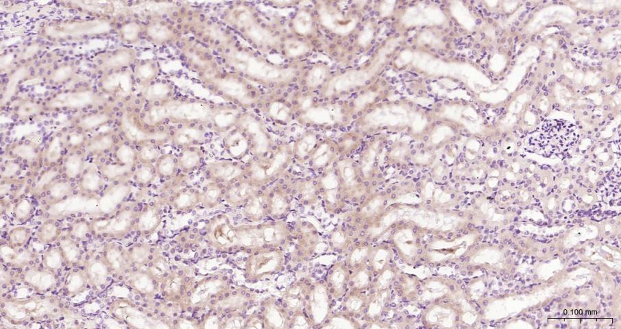 eIF4E Recombinant Rabbit mAb(b