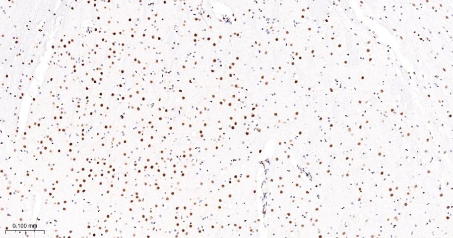 Oct-1 Recombinant Rabbit mAb(b