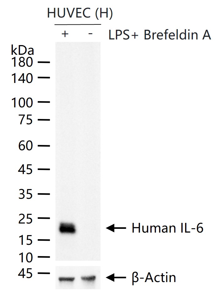 Human IL-6 Recombinant Rabbit 