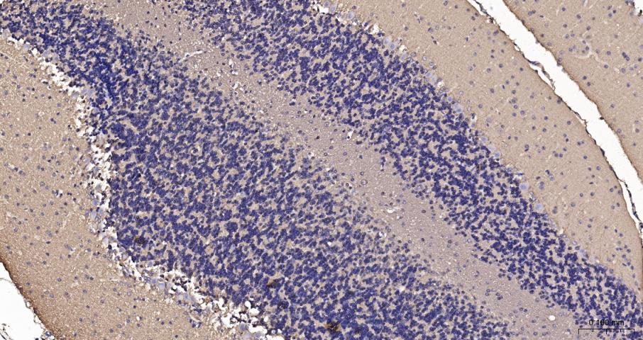 beta I Tubulin Recombinant Rab