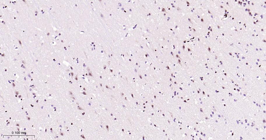 CTBP2 Recombinant Rabbit mAb(b